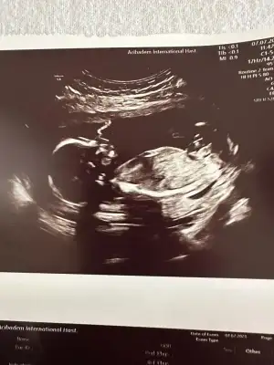 WhatsApp Image 2023-07-07 at 17.11.24.webp