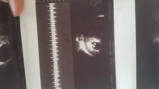 1690527306243200786273.webp