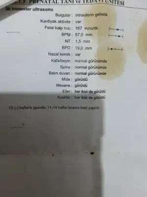 16954909321022535607782556038036.webp