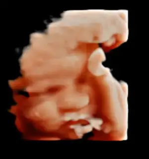 Screenshot_20231010_194751_Video Player.webp