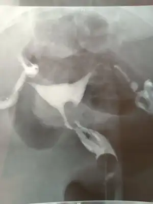 17022128473783565791827184816000.webp