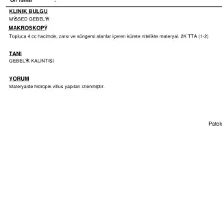 Screenshot_2023-12-16-22-53-20-112_com.mi.globalbrowser~2.webp