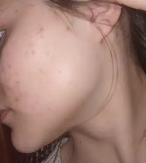 20240309_115455.webp