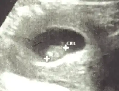 Screenshot 2024-04-07 at 15.41.10.webp