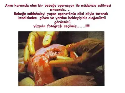 $DOKUNMAK.webp