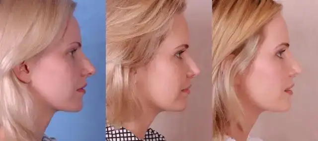 $Andrea-three-profile-1024x454.webp