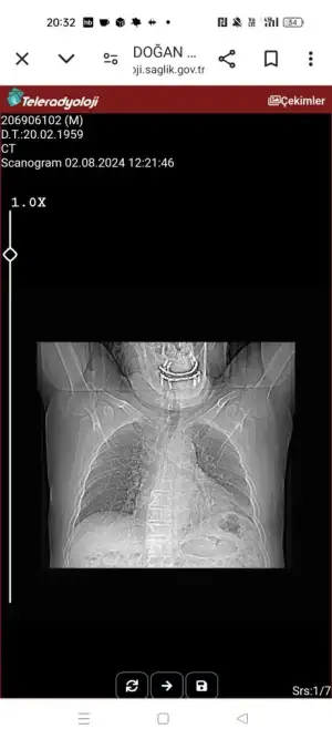 Screenshot_2024-08-04-20-32-28-32_40deb401b9ffe8e1df2f1cc5ba480b12.webp