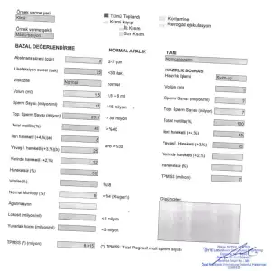son test.webp