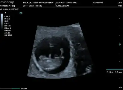IMG-20241128-WA0009.webp