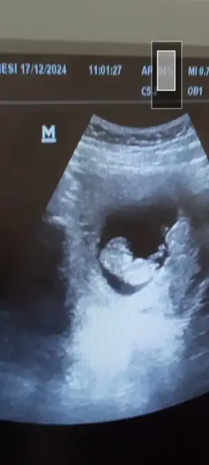 Screenshot_20241218-162822_Video Player.webp