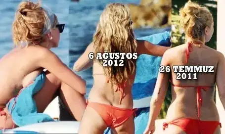 $hadise-nasil-kilo-verdi.webp
