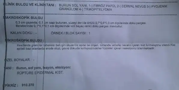 $Foto&#287;raf358.webp