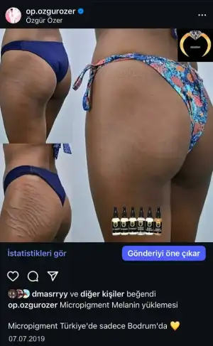 C5C0D9FC-243E-489D-AC13-2DF4AF4929A6.webp
