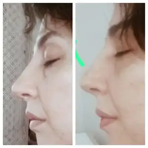 InCollage_20250223_135001959.webp