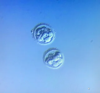 IMG-20250228-WA0019.webp