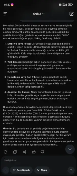 Screenshot_2025-05-01-15-27-20-454_ai.x.grok.webp