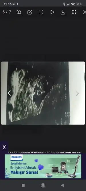Screenshot_2025-05-06-23-16-37-308_com.android.chrome.webp