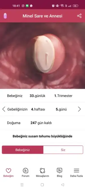 Screenshot_2025-05-17-18-41-52-44_380ee66ce8529d8f29c75d0bc68d3f3a.webp