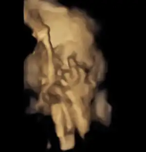 6653ba56-2ab8-4831-bc13-158736262258.webp