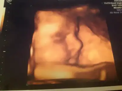 $foto&#287;raf (3).webp