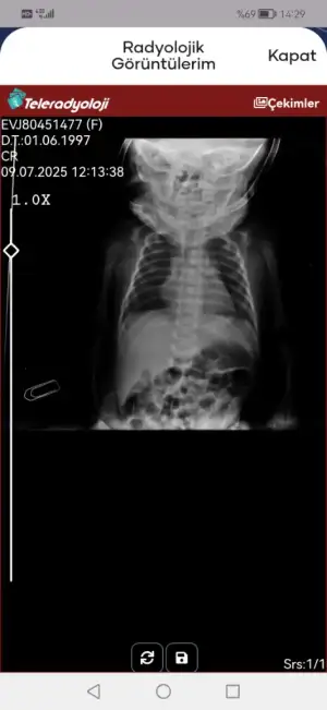 Screenshot_20250709_142908_tr.gov.saglik.enabiz.webp