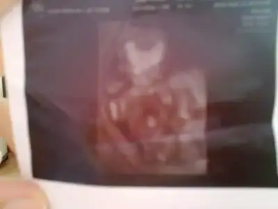 $02102010174.webp