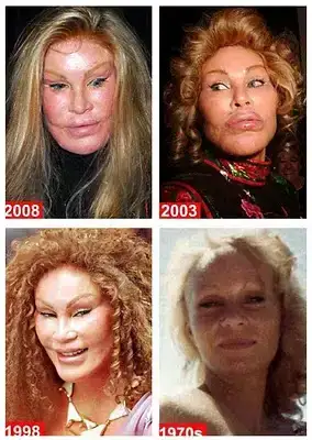 $CatWomanPlasticSurgery.webp
