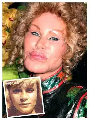 $CatWomanPlasticSurgerykk.webp