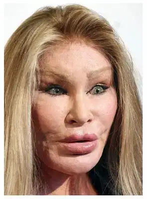 $CelebrityPlasticSurgeryGoneWrong.webp