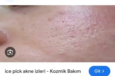 1000090461.webp