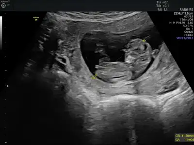 Image_2.webp