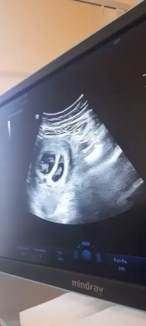 Screenshot_20251010_171241_Video Player.webp