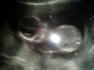 $2012-11-26 16.02.17.webp