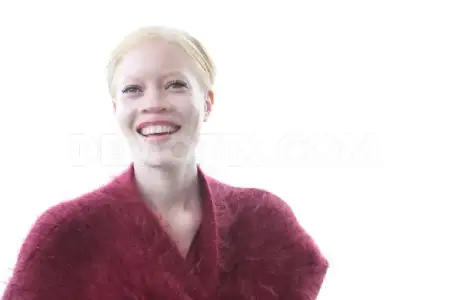 $1352102238-africanamerican-albino-top-model-diandra-forrest_1572636.webp