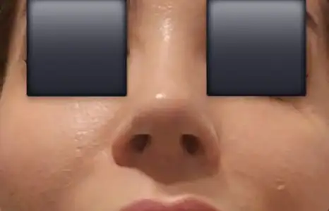 1000343571.webp