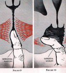 $kegel exercises.gif