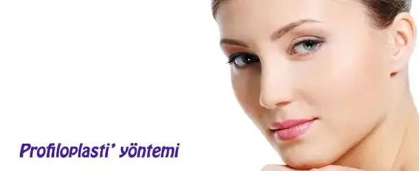 profiloplasti_yontemi.webp