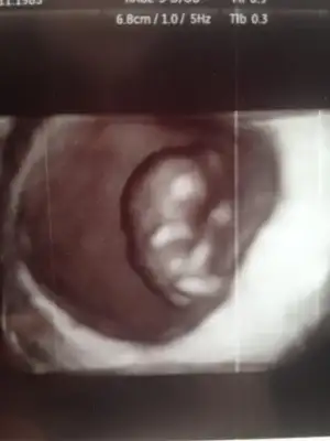 $foto&#287;raf (4).webp