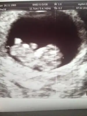 $foto&#287;raf (3).webp