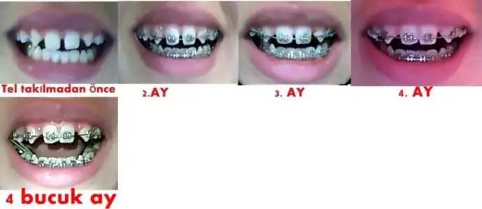 $mvhvjy.webp