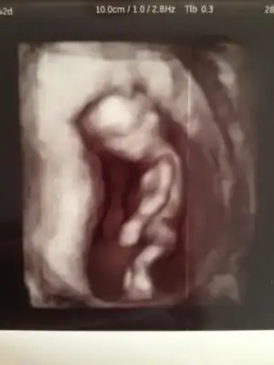 $foto&#287;raf (6).webp