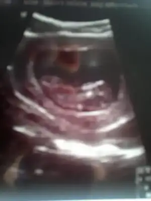 $01032013233.webp