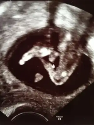 $foto&#287;raf (7).webp