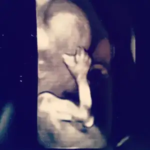 $foto&#287;raf (10).webp