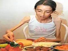 $anoreksiya (1).webp