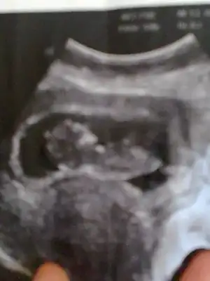 $G_r_nt_021 (1).webp