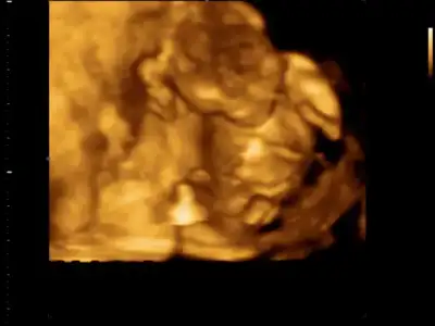 $BABY_0001.webp