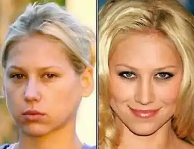 $anna-kournikova-eski_yeni.webp