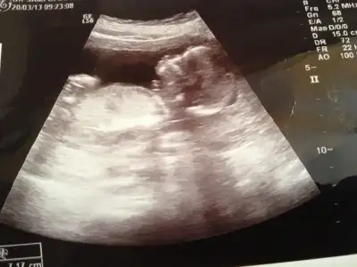 $IMG_301011.webp $IMG_301011.webp