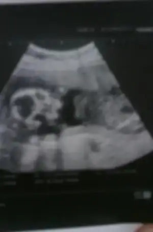 $IMAG0863.webp $IMAG0863.webp